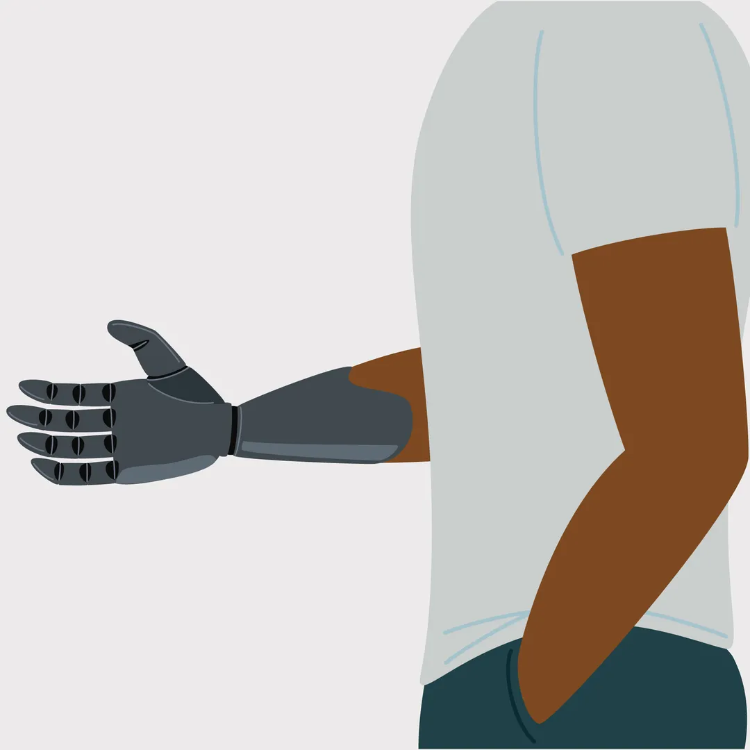 bras prothétique